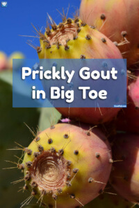 Prickly Gout in Big Toe photo